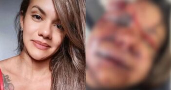 Mulher espancada com mais de 60 socos recebe alta após cirurgia de 7 horas no rosto